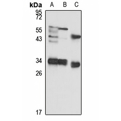 NUDT5 Rabbit Polyclonal Antibody
