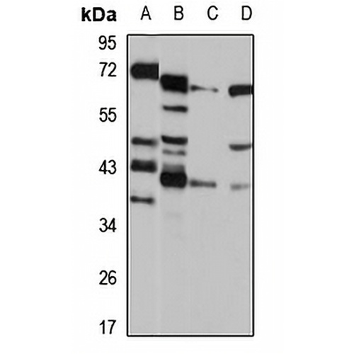 NUDT9 Rabbit Polyclonal Antibody
