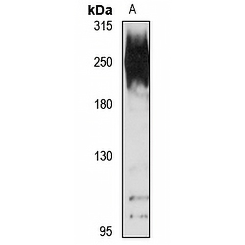 NUP210 Rabbit Polyclonal Antibody