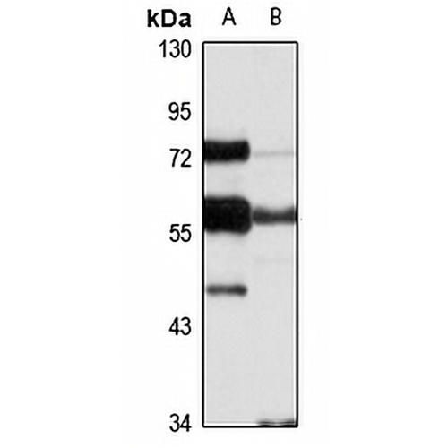 NUP50 Rabbit Polyclonal Antibody