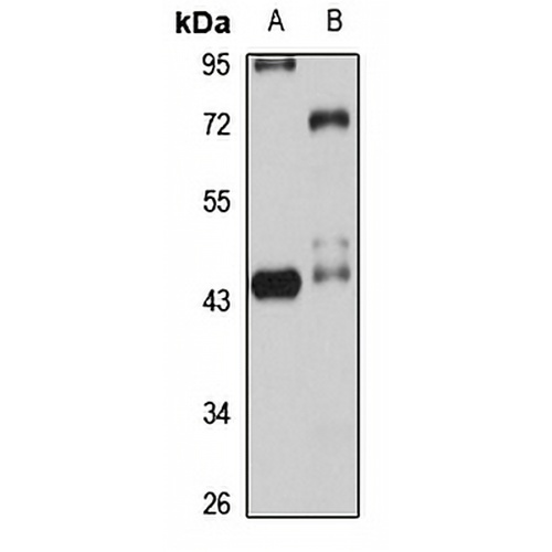 NUPL2 Rabbit Polyclonal Antibody
