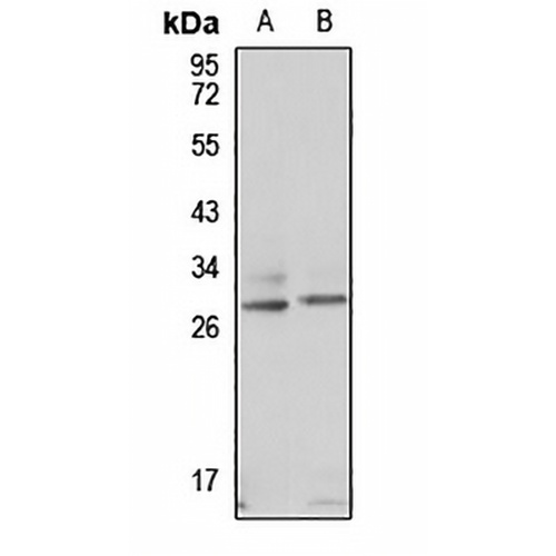 ODF1 Rabbit Polyclonal Antibody