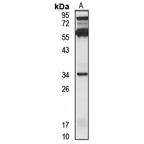 OR2S2 Rabbit Polyclonal Antibody