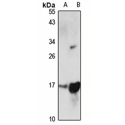 ORMDL3 Rabbit Polyclonal Antibody
