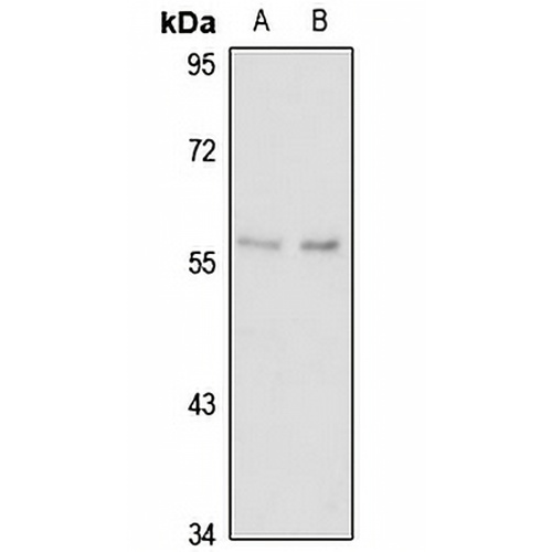 ORP-2 Rabbit Polyclonal Antibody