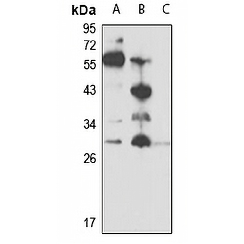 Oncostatin M Rabbit Polyclonal Antibody