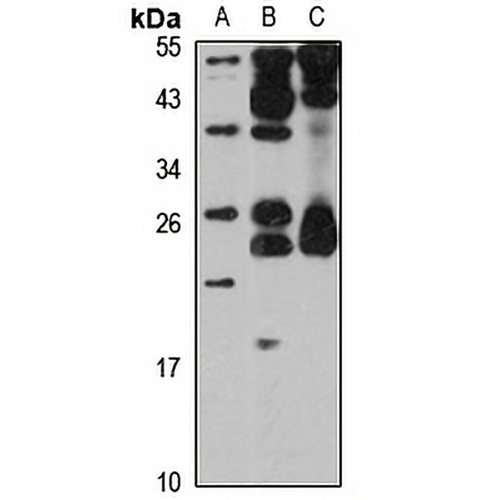 OSTF1 Rabbit Polyclonal Antibody
