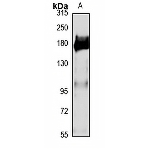 OTUD4 Rabbit Polyclonal Antibody