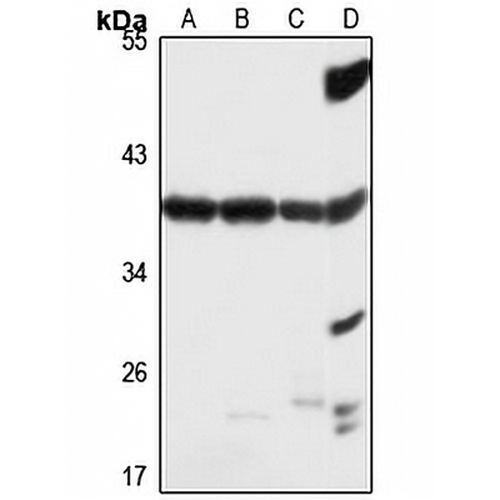 OTUD6B Rabbit Polyclonal Antibody