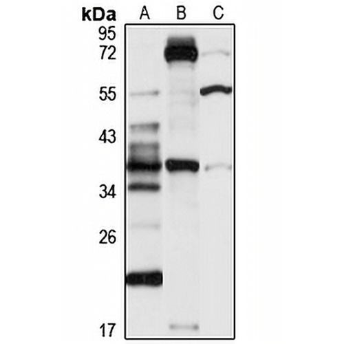 GPR80 Rabbit Polyclonal Antibody