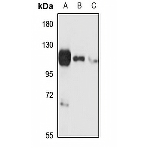 P2X5 Rabbit Polyclonal Antibody