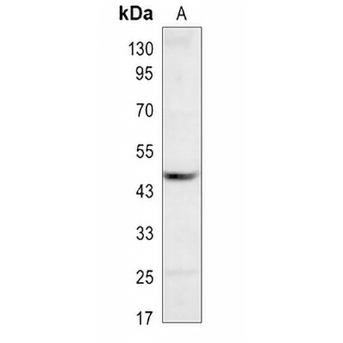 P4H-TM Rabbit Polyclonal Antibody