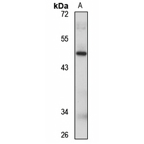 PACSIN1 Rabbit Polyclonal Antibody