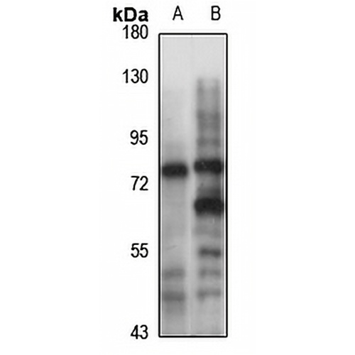 PADI2 Rabbit Polyclonal Antibody