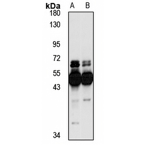CBP Rabbit Polyclonal Antibody