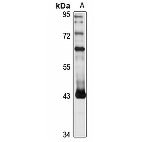 HPIP1 Rabbit Polyclonal Antibody