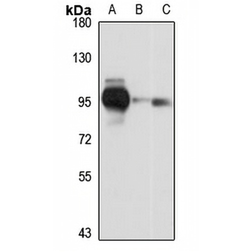PALD1 Rabbit Polyclonal Antibody