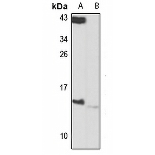 Magmas Rabbit Polyclonal Antibody