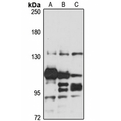 PAN2 Rabbit Polyclonal Antibody
