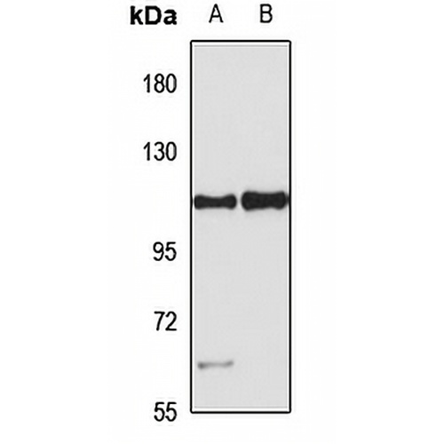 PARP10 Rabbit Polyclonal Antibody