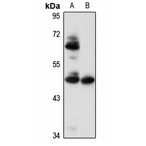 PBX1 Rabbit Polyclonal Antibody