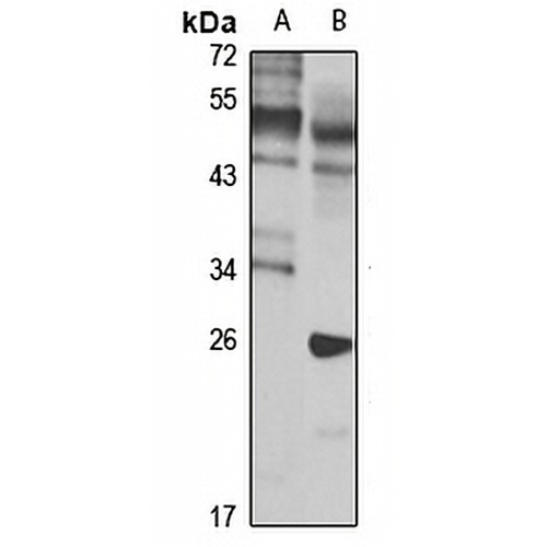 PBX1 Rabbit Polyclonal Antibody