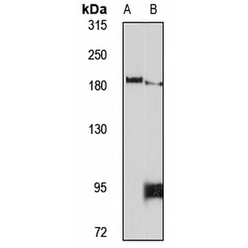 PCF11 Rabbit Polyclonal Antibody