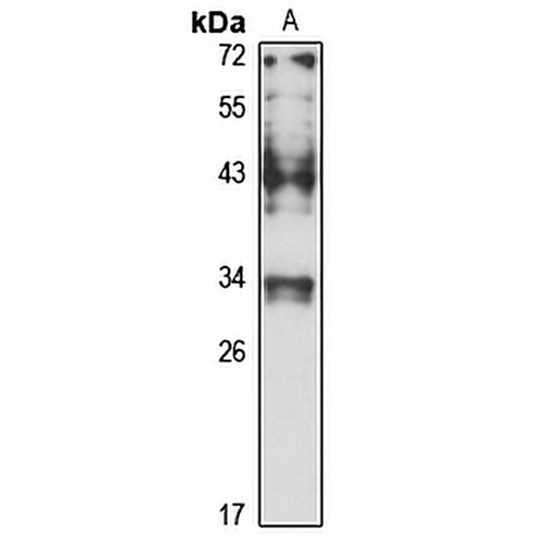 PDCL Rabbit Polyclonal Antibody