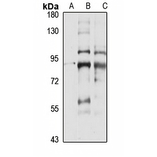PDE1C Rabbit Polyclonal Antibody