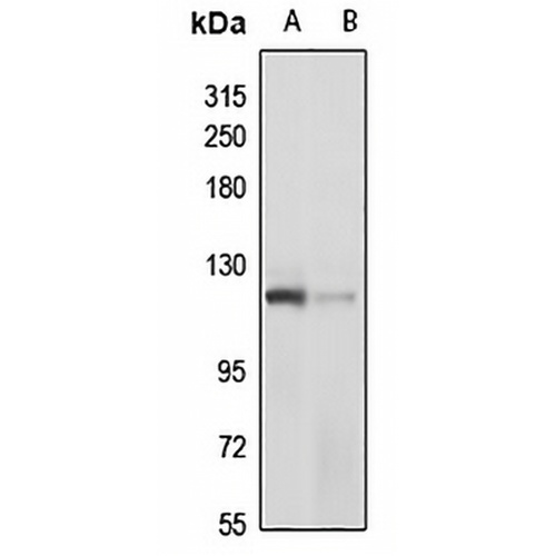 PDE3A Rabbit Polyclonal Antibody