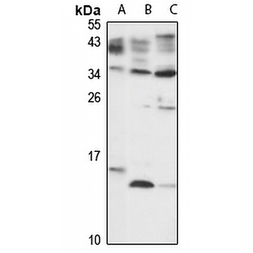 PDE6D Rabbit Polyclonal Antibody