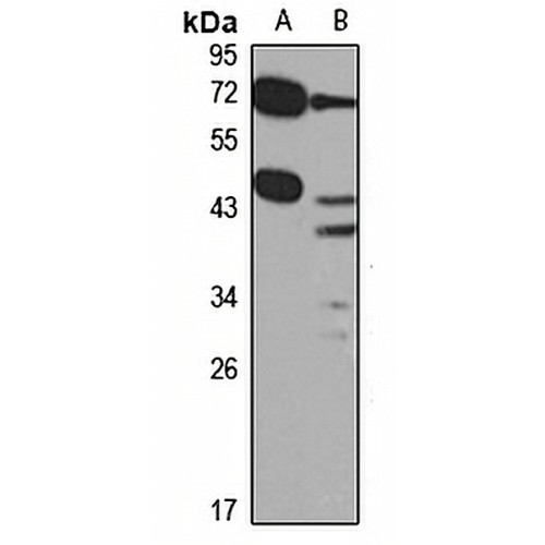 PDGFD Rabbit Polyclonal Antibody