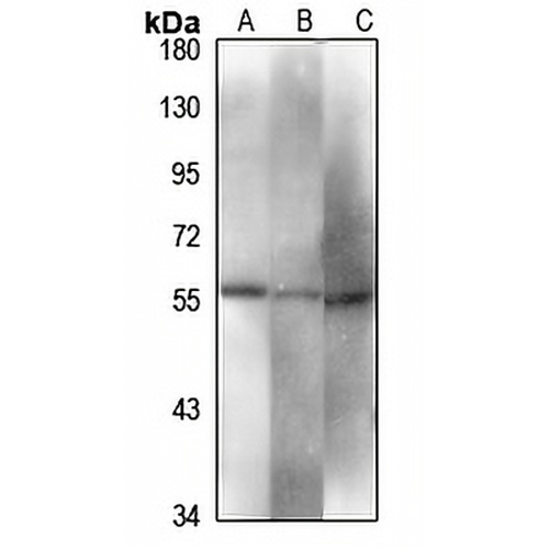 PDIA2 Rabbit Polyclonal Antibody