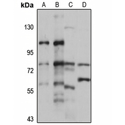 PDP2 Rabbit Polyclonal Antibody