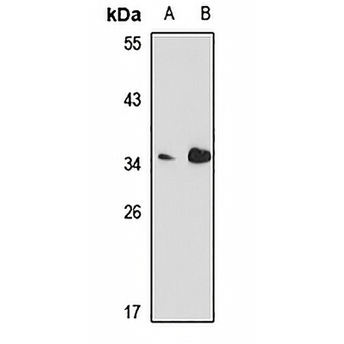 Podoplanin Rabbit Polyclonal Antibody