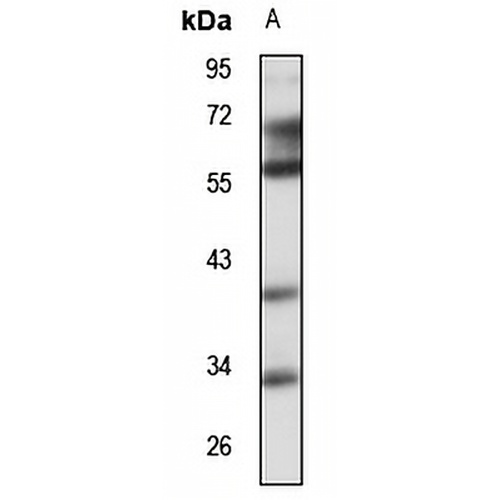 PDSS2 Rabbit Polyclonal Antibody