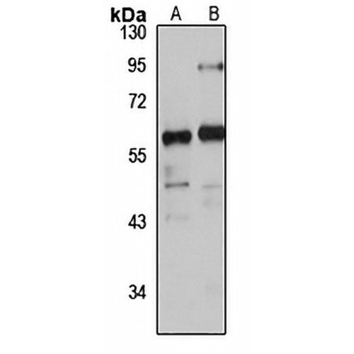 PDZK2 Rabbit Polyclonal Antibody