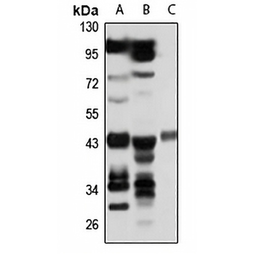 PELO Rabbit Polyclonal Antibody