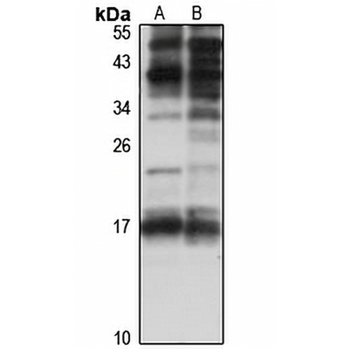 Perp Rabbit Polyclonal Antibody