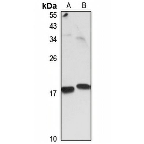 Prefoldin 4 Rabbit Polyclonal Antibody