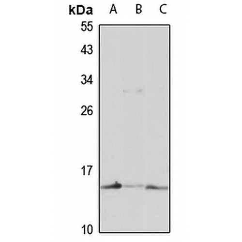 Prefoldin 5 Rabbit Polyclonal Antibody