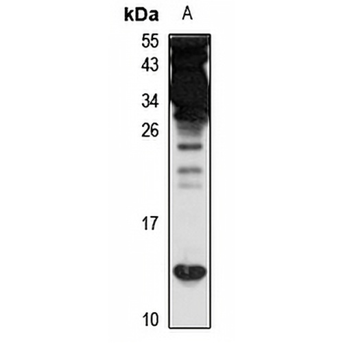 Prefoldin 6 Rabbit Polyclonal Antibody