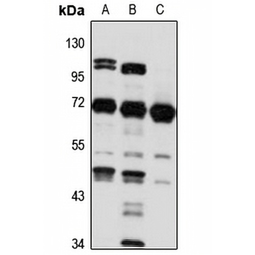 PGM 2 Rabbit Polyclonal Antibody