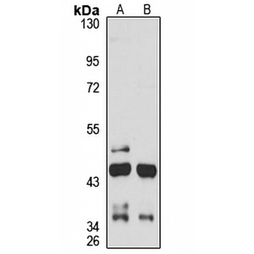 PHC2 Rabbit Polyclonal Antibody