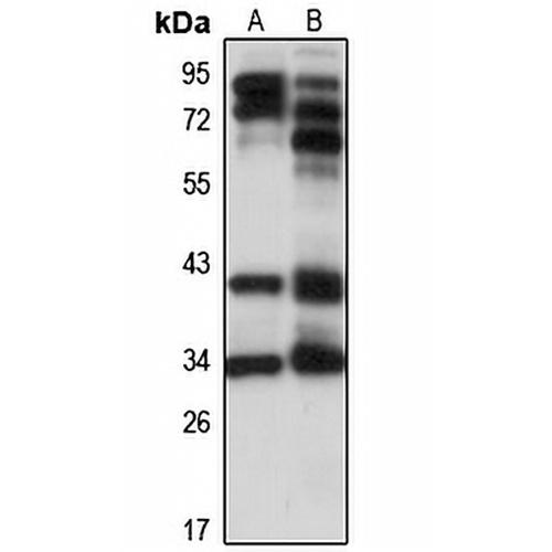 PHF10 Rabbit Polyclonal Antibody