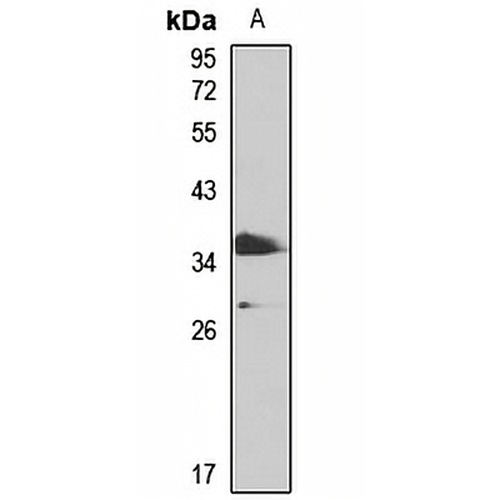 PHF11 Rabbit Polyclonal Antibody