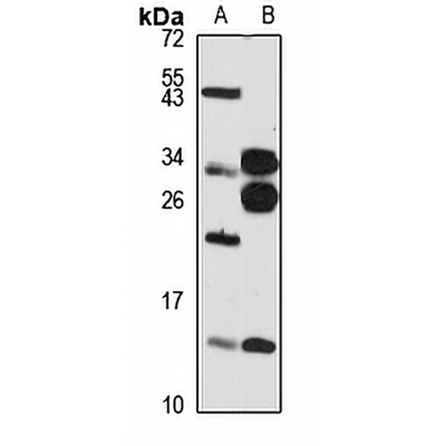 PHF5A Rabbit Polyclonal Antibody