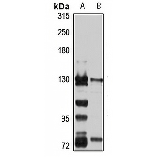 PHKA2 Rabbit Polyclonal Antibody