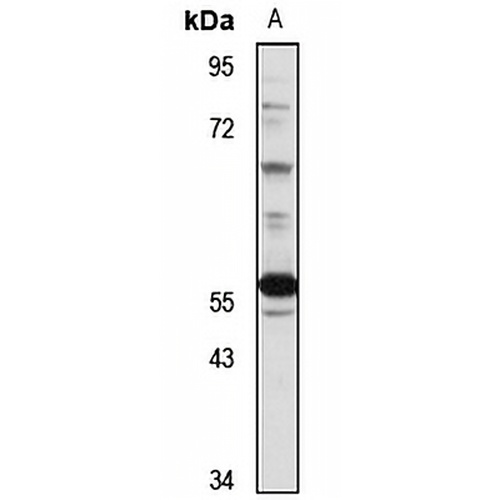 PI4K2A Rabbit Polyclonal Antibody