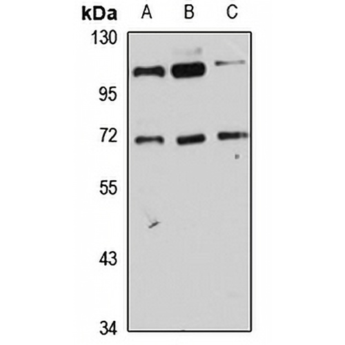 PIG-T Rabbit Polyclonal Antibody
